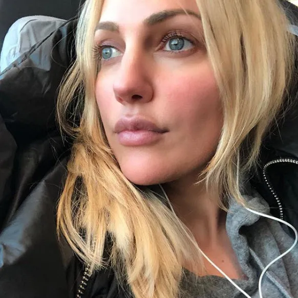 Meryem Uzerli, 'Hollywood yanağı' yaptırdı-4