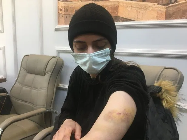 Rezidansta işkence gören Demet A'nın bilirkişi raporu ortaya çıktı! Sigara yanığı, boyun çevresinde ve yüzünde bıçak çizikleri...-4