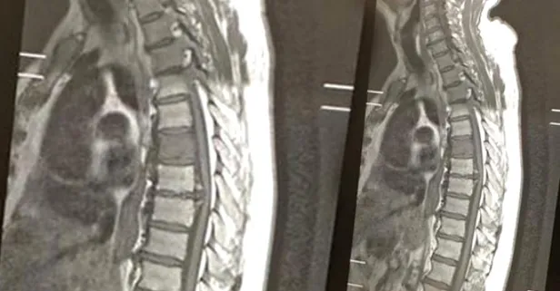 70 yaşındaki adamın içinden köpek çıktı