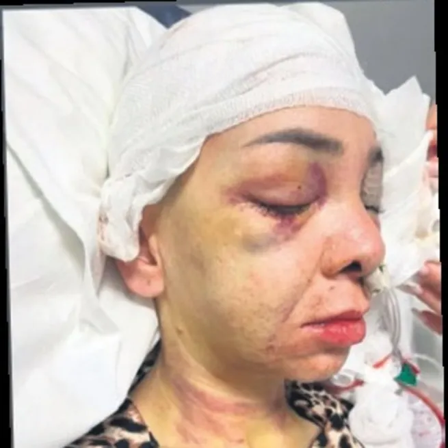Şehir eşkıyaları eğlenceyi kabusa çevirdi: Anne ve oğluna meydan dayağı