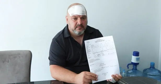 Ev sahibi dehşeti! Kiracısına beyzbol sopasıyla saldırdı