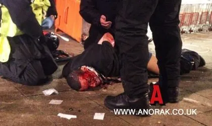 İngiltere’de polisten göstericiye öldüresiye dayak!