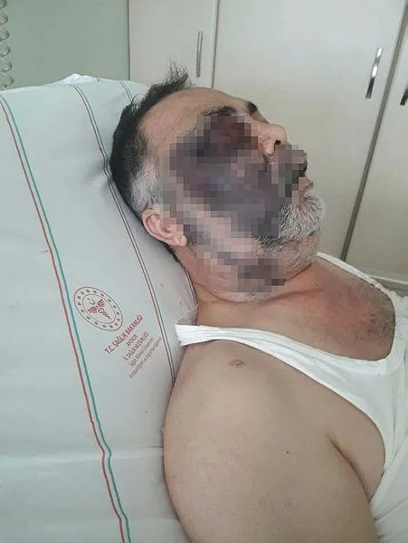 antalyada-darbedilen-yuzde-90-engelli-mumun-kara-hayatini-kaybetti-2-tutuklama-1614550645537.jpeg Antalya'da darbedilen yüzde 90 engelli Mümün Kara hayatını kaybetti! 2 tutuklama...-4