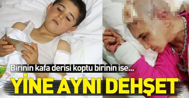 Antalya'da köpek dehşeti! Kafa derisi koptu