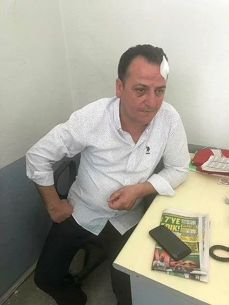 “Belediyede dayak yedim” diye iftira atan taksici Engin Dürü itiraf etti: İYİ Partililer vaatlerde bulundu-2