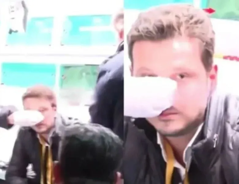 Bu yumruk Türk basınına