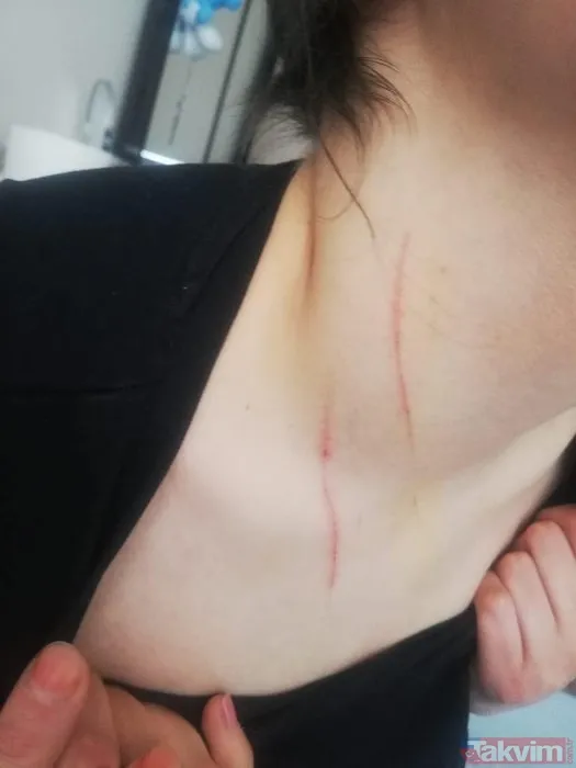 Kadınlardan kadınlara korkunç taciz ve işkence! Mağdur sayısı artıyor! "Yüzümde sigara söndürdüler" - 15