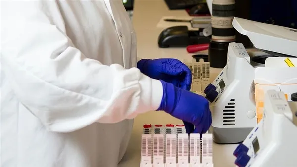 japon-arastirmacilar-kovid-19u-5-dakikada-saptayabilen-test-yontemini-buldu-1618897137607.jpg Japon araştırmacılar Kovid-19'u 5 dakikada saptayabilen test yöntemini buldu-2