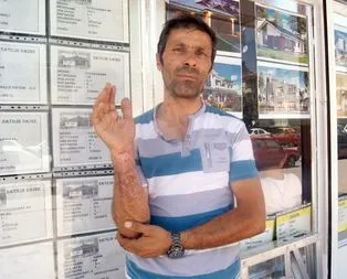 Sigara böreği patladı: 1 yaralı! Yanlış okumadınız