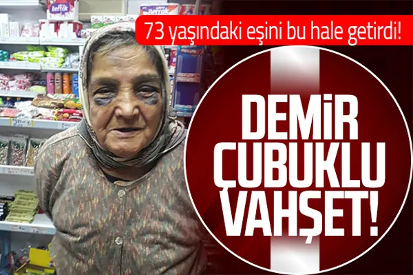 Kocaeli'de kan donduran olay! 73 yaşındaki eşini demir çubukla bu hale getirdi!-1