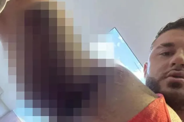 Ağırlık çalışırken dehşeti yaşadı! Sporcunun göğüs kasları bir anda yerinden fırladı! Kemiğinden koptu...