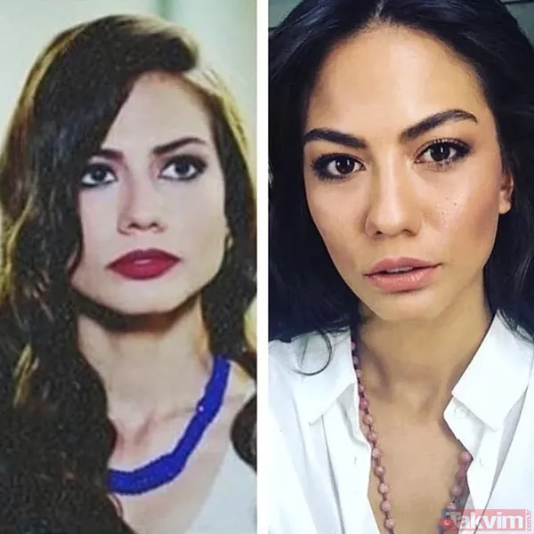 Safiye Soyman'ın son haline bakın "20 yıl geriye gittim genç kız gibi oldum" Seda Sayan'ın 'kobayı' Safiye estetikten sonra... - 47