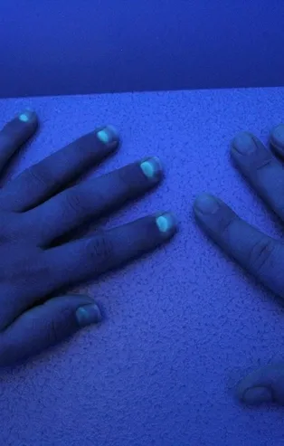 Koronavirüsü atlatan kişilerde şoke eden 'tırnak' detayı! Fabrika çalışanları fark etti