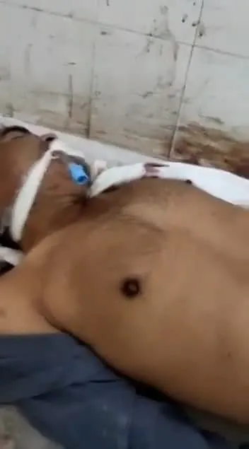 morgda-canlandi-kan-donduran-anlar-kamerada-iste-inanilmaz-anlar-1637758883922.jpg Morgda canlandı! Kan donduran anlar kamerada.... İşte inanılmaz anlar-7