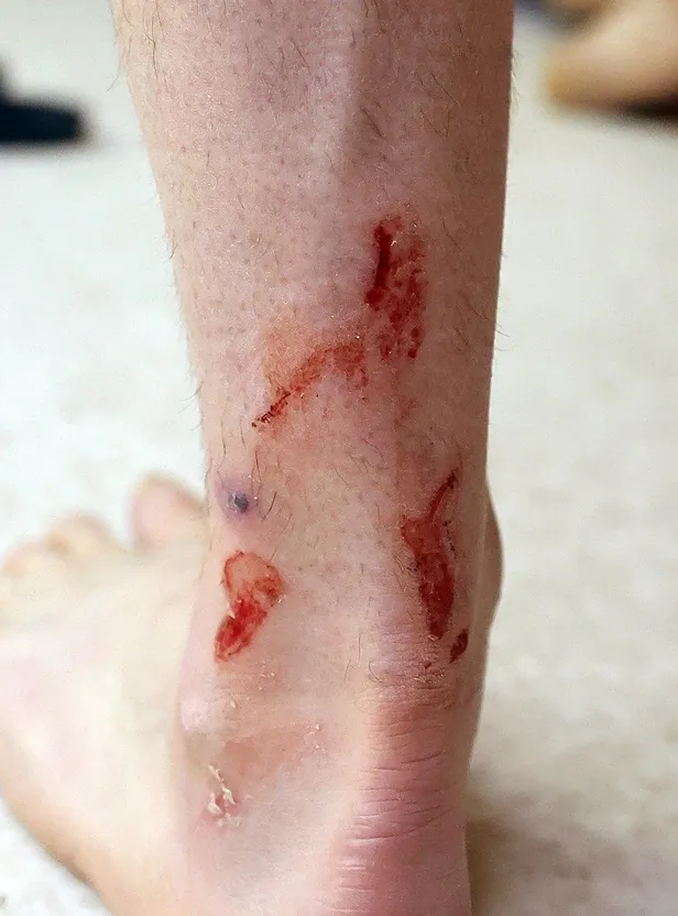 galatasaraydan-ve-kerem-akturkoglundan-hakem-kararlarina-isyan-iki-pozisyonda-ayagim-kirilabilirdi-1647797777168.jpeg Galatasaray'dan ve Kerem Aktürkoğlu'ndan hakem kararlarına isyan: "İki pozisyonda ayağım kırılabilirdi"-4