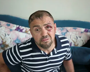 Bursada insanlık dışı olay! Terör gazisini öldüresiye dövdüler