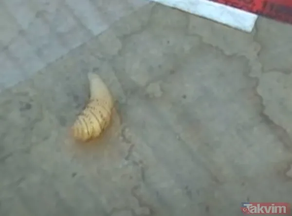 Karnındaki şişlik için gitti içinden çıkan doktorları bile şoke etti! Yer uzak değil Kayseri! 64 kilo girdi 55 kilo çıktı - 49