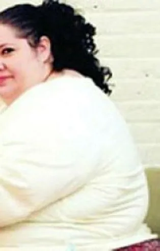 Beyaz tenli kadınların dikkatine! Obezite ve kanser...