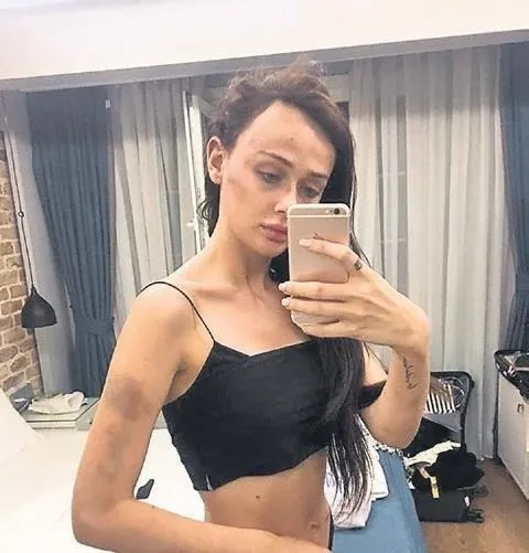 Sırp model Tanja Dukiç'in darbedilmesi davasında flaş gelişme: Dosya uzlaşma büroya gönderildi-5