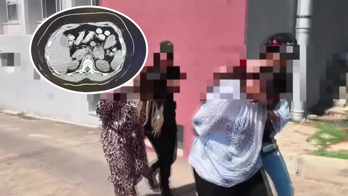 Bağırsakta uyuşturucu sevkiyatı! İki kadının midesinden 1,5 kilo metamfetamin çıktı