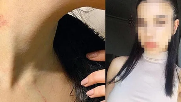 SON DAKİKA: Genç kadın lüks otelde kabusu yaşadı: Asansöre çekti odaya sürükledi-2