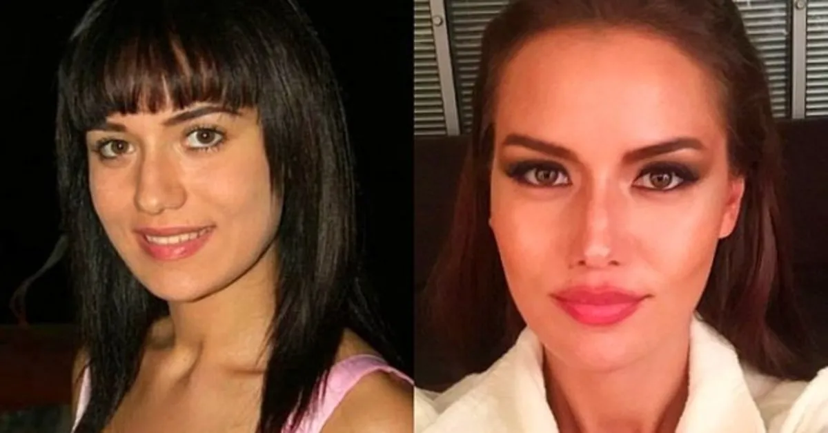 son hali oldukca sasirtti burak ozcivit in esi fahriye evcen in goruntuleri sosyal medyayi karistirdi galeri takvim