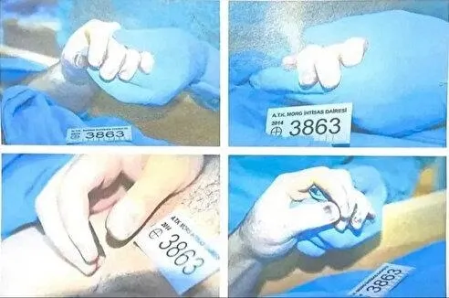 sir-cozulecek-mi-cem-garipoglunun-mezari-aciliyor-1727345885657.jpeg Cem Garipoğlu'nun otopsi görüntüleri (Takvim.com.tr Fotoğraf Arşivi)