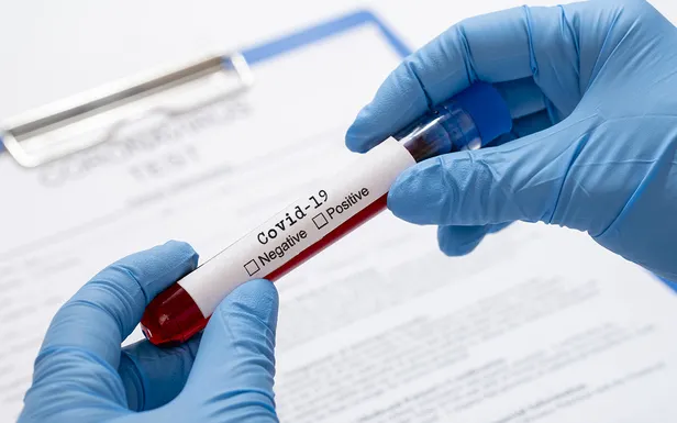 Çinli bilim insanından dünyanın tüylerini ürperten açıklama! Koronavirüs...-5