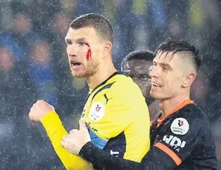 Edin Dzeko kanlar içinde!