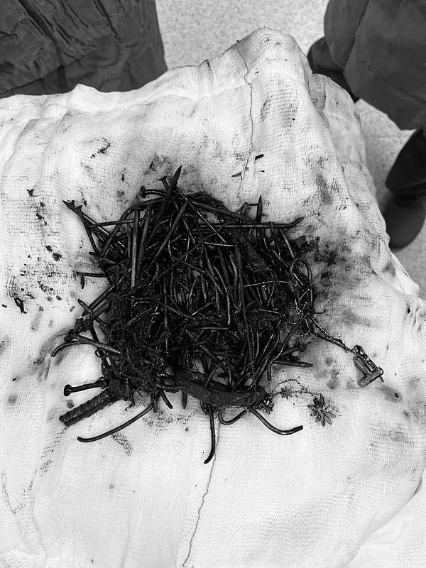 karin-agrisiyla-hastaneye-gitti-midesinden-cikanlar-doktorlari-bile-sasirtti-1734431057645.jpeg Zihinsel engelli kadın hastanın midesinden 1 kilo metal cisim çıktı (Fotoğraf: DHA)