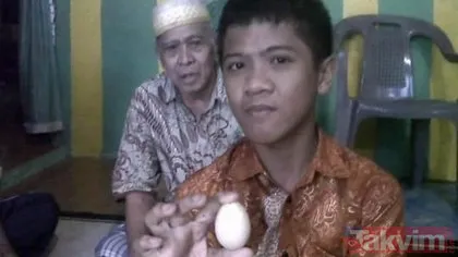 Doktorlar bile şokta! Endonezya’da yaşayan çocuk tavuk gibi yumurtluyor