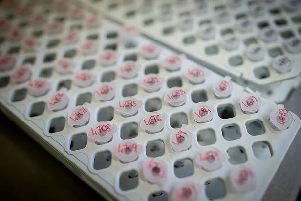 Koronavirüsle ilgili şoke eden iddia! 2004 yılında Fransa'da...-2