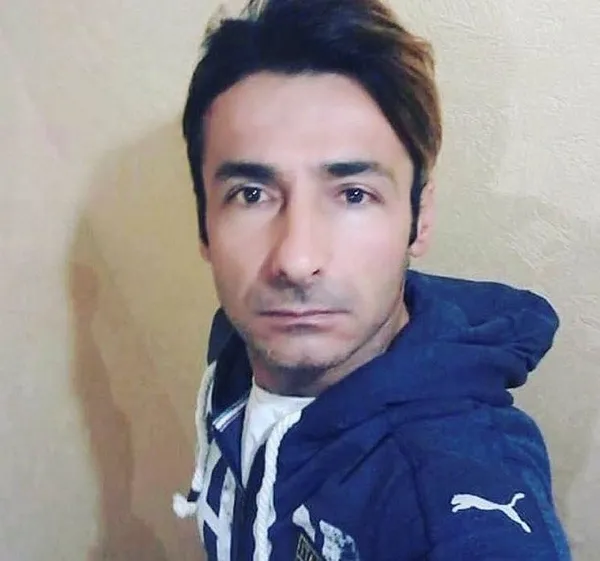 Eşi falçatayla saldırdı Ukraynalı Hanna Butym'un yüzünün bir kısmı felç kaldı!-3