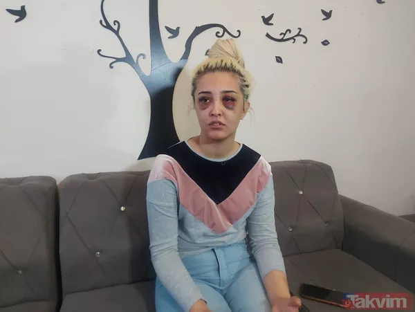 Eski sevgilisine dehşeti yaşattı: Ayrılmayı kabul etmedi 3 saat boyunca darp ederek tanınmaz hale getirdi! - 11