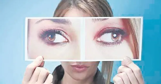 Şaşılık aileden miras! Bu belirtilere dikkat edin...