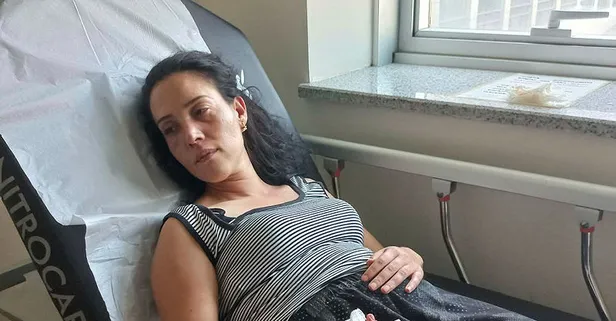 Gözü dönen cani koca dehşet saçtı! Önce dövdü sonra parmağını kesti