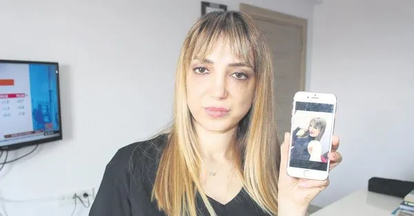 badem goz estetigi yaptirmak istedi yuzu taninmaz hale geldi takvim