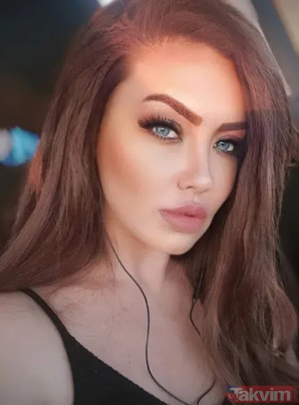 Şarkıcı Lara sonunda küçülttü! Estetikle bambaşka biri olan Lara paylaştı görenler 'yok artık' dedi - 13