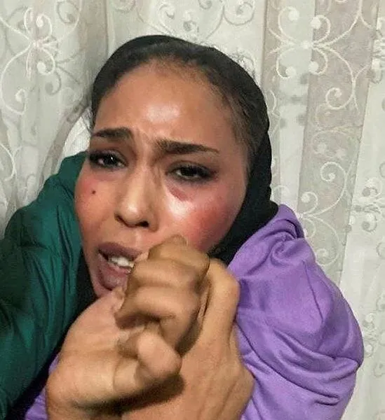 istiklal-caddesindeki-kalles-saldirida-gozalti-sayisi-48e-yukseldi-terorist-albashirin-evinde-arama-iste-ele-g-1668463832291.jpeg İstiklal Caddesi'ndeki kalleş saldırıda gözaltı sayısı 48'e yükseldi! Terörist Albashır'in evinde arama: İşte ele geçirilenler-2