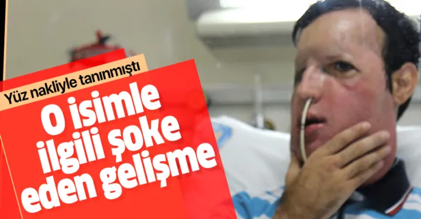 Türkiye'nin beşinci yüz nakli yapılan Recep Sert Bilecik'te tutuklandı