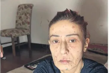 Hayatı arapsaçı