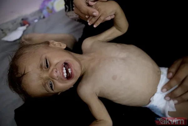 Gazze’de iki yıllık soykırım! On binlerce şehit, on binlerce yaralı: İsrail tüm kaynakları yok ediyor - 19