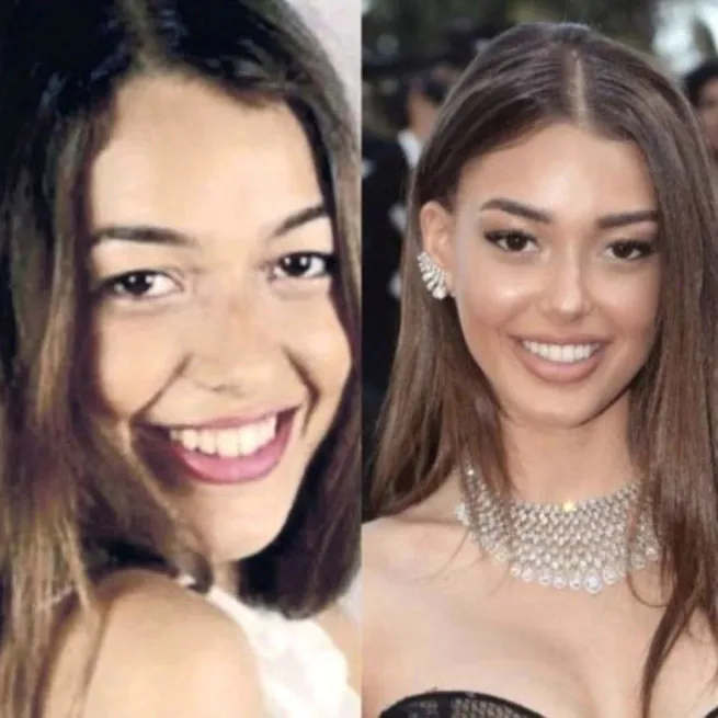 Yasemin Özilhan estetik açıklamasıyla sosyal medyanın diline düştü: Yeme bizi Yasemin! - 10