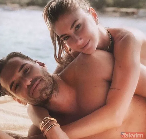 Acun Ilıcalı'nın yüzü gözü morluk içinde gören darp edildi sanıyor ama işin aslı başka! Estetik mi derken... - 33