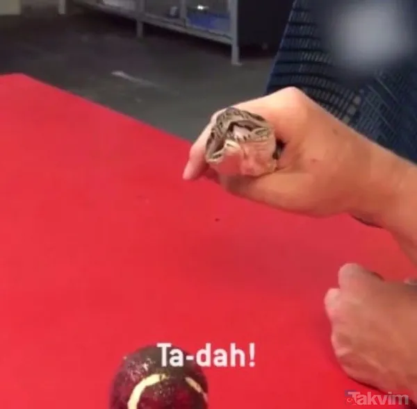 Midesine güvenenler baksın! Kulak ağrısıyla hastaneye giden adamın kulağından çıkanlar dünyayı şoke etti - 43