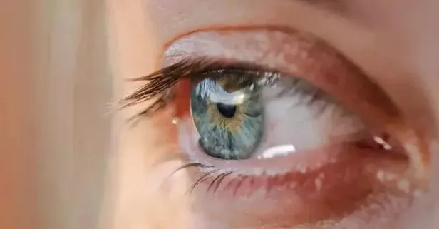 goz-kapaginin-ic-kismindaki-bu-delik-bakin-ne-ise-yariyor-1710336253572.jpg Göz kapağının sağ sol iç kısımlarındaki bu delik bakın ne işe yarıyormuş-6