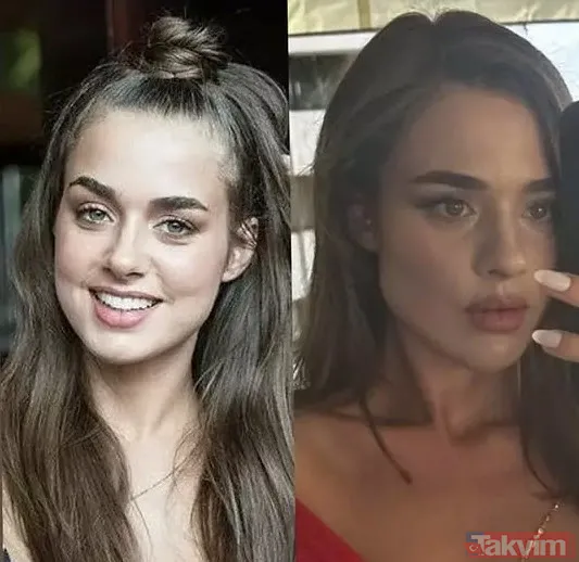 Bensu Soral "Hiç estetiğim yok kendimi güzel bulmuyorum" dedi ortalık birbirine girdi "Tabi biz de yedik" Yüzündeki değişim çok konuşulmuştu - 11