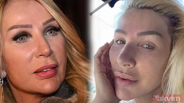 Seda Sayan'dan botoks itirafı: Botokslar, dolgular gitti bacım! Bu halleri olay yarattı - 1