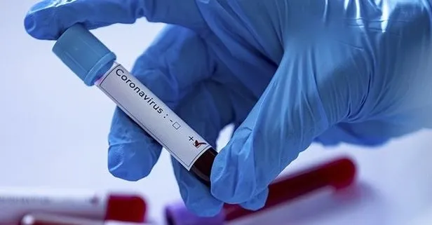 Ardahan’ın Çıldır ilçesinde ilk kez koronavirüs vakası tespit edildi