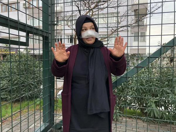 yuruyus-yaparken-pitbull-saldirisina-ugradi-burnu-parcalandi-1638539571335.jpg Yürüyüş yaparken pitbull saldırısına uğradı! Burnu parçalandı-5